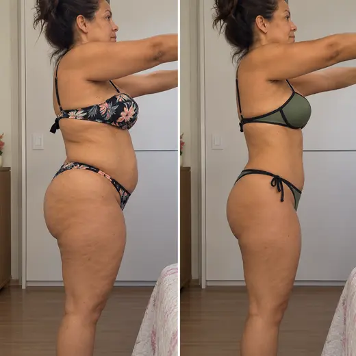 Antes e depois de cliente