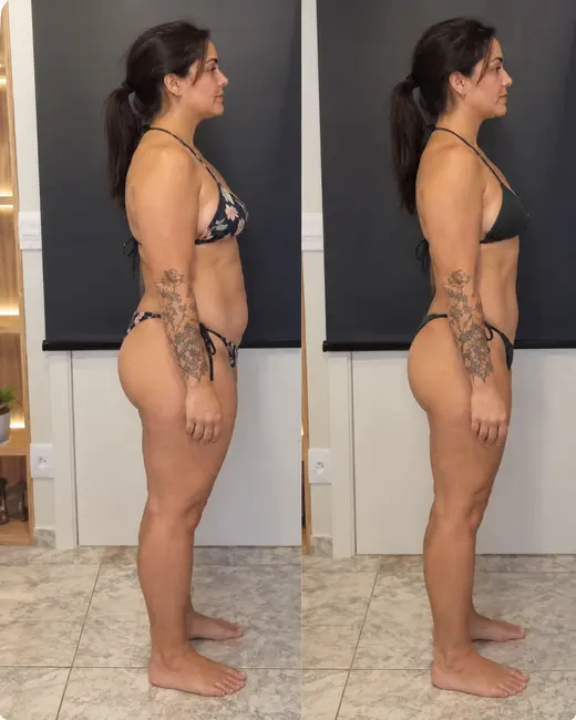 Antes e depois de cliente